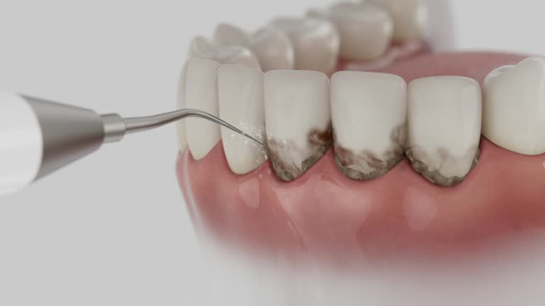 Reliable Emergency Dentist contractor in Clarcona, FL by Smile Center Dentistry